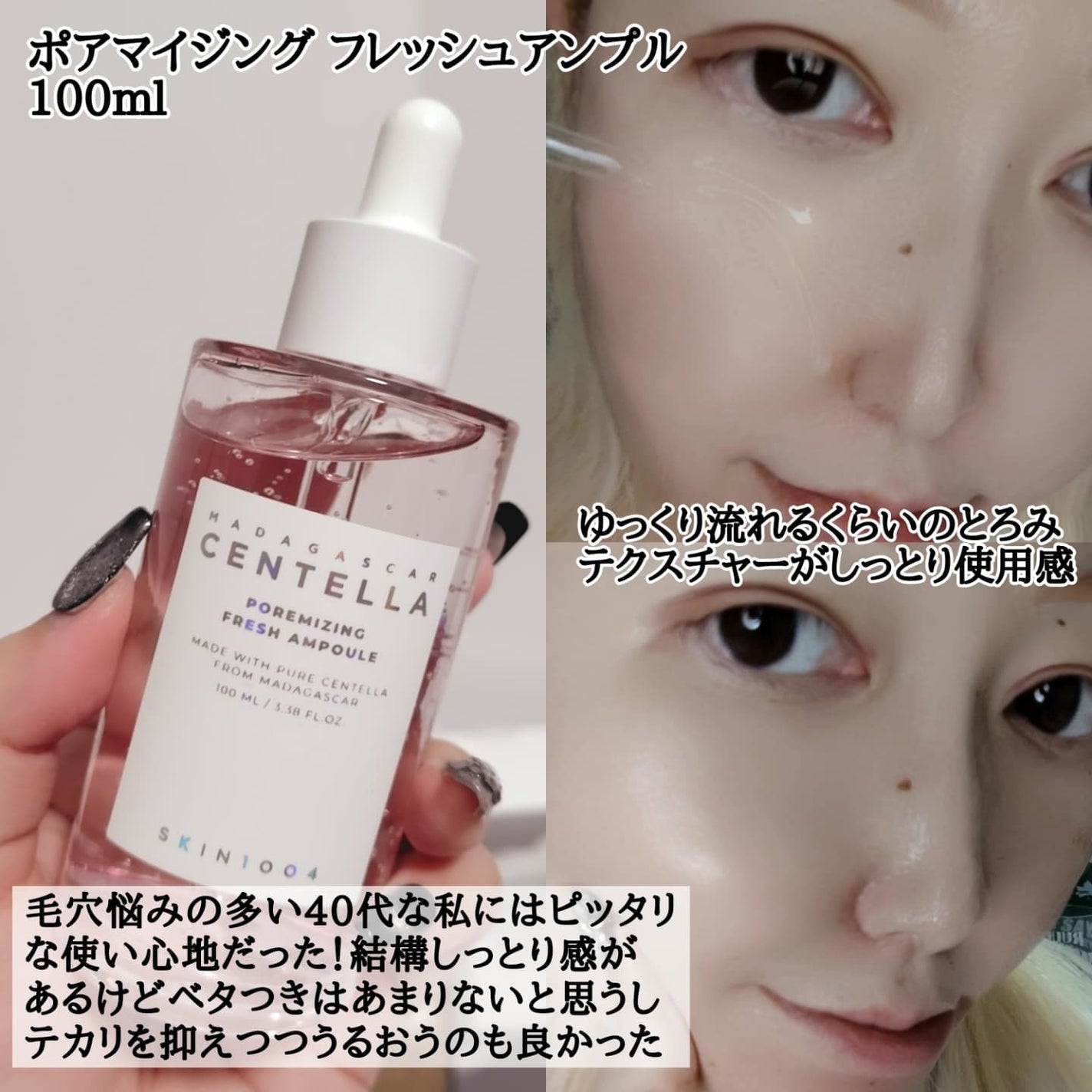 センテラ アンプル/SKIN1004/美容液を使ったクチコミ(7枚目)