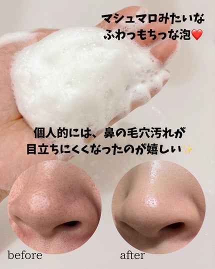 BnD マシュマロ コラーゲン AHA スクラブ /BnD/ボディスクラブを使ったクチコミ(4枚目)