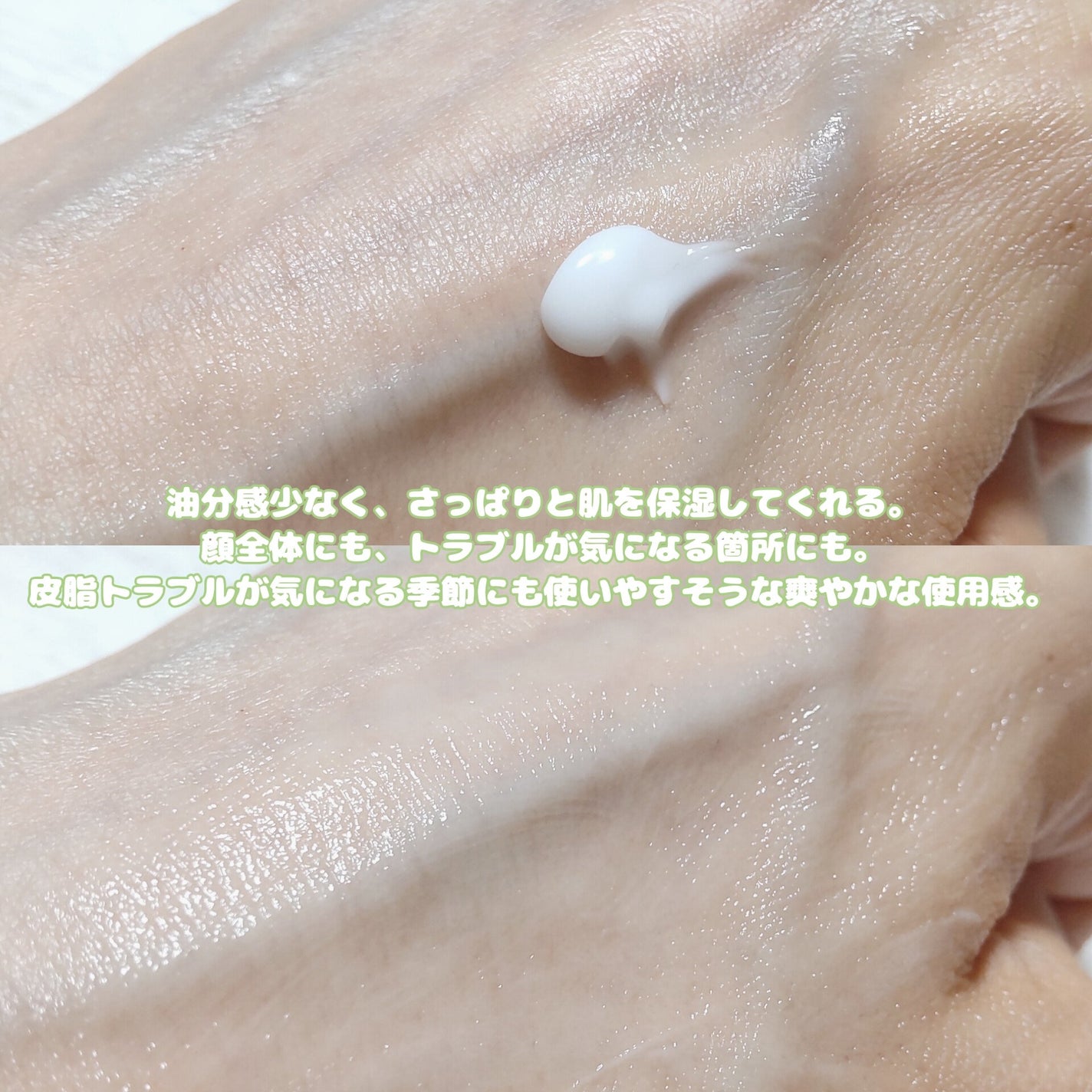 ノスカナイン トラブル セラム/FATION/美容液を使ったクチコミ(8枚目)