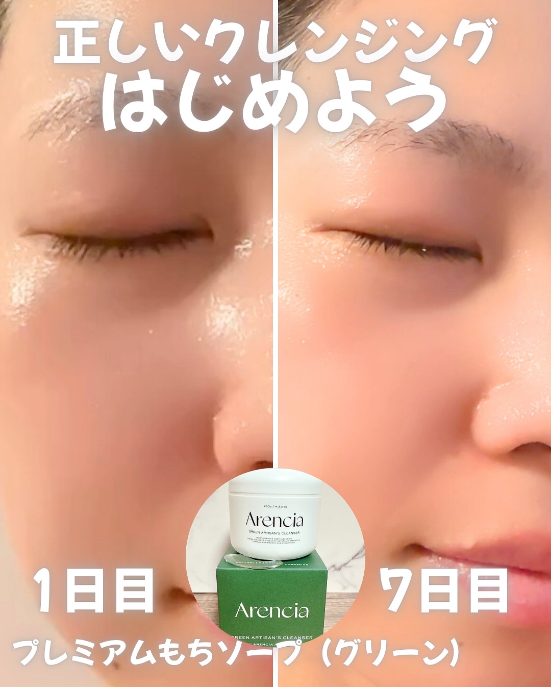 プレミアムもちソープ「グリーンアルティザン」/アレンシア/その他洗顔料を使ったクチコミ（1枚目）