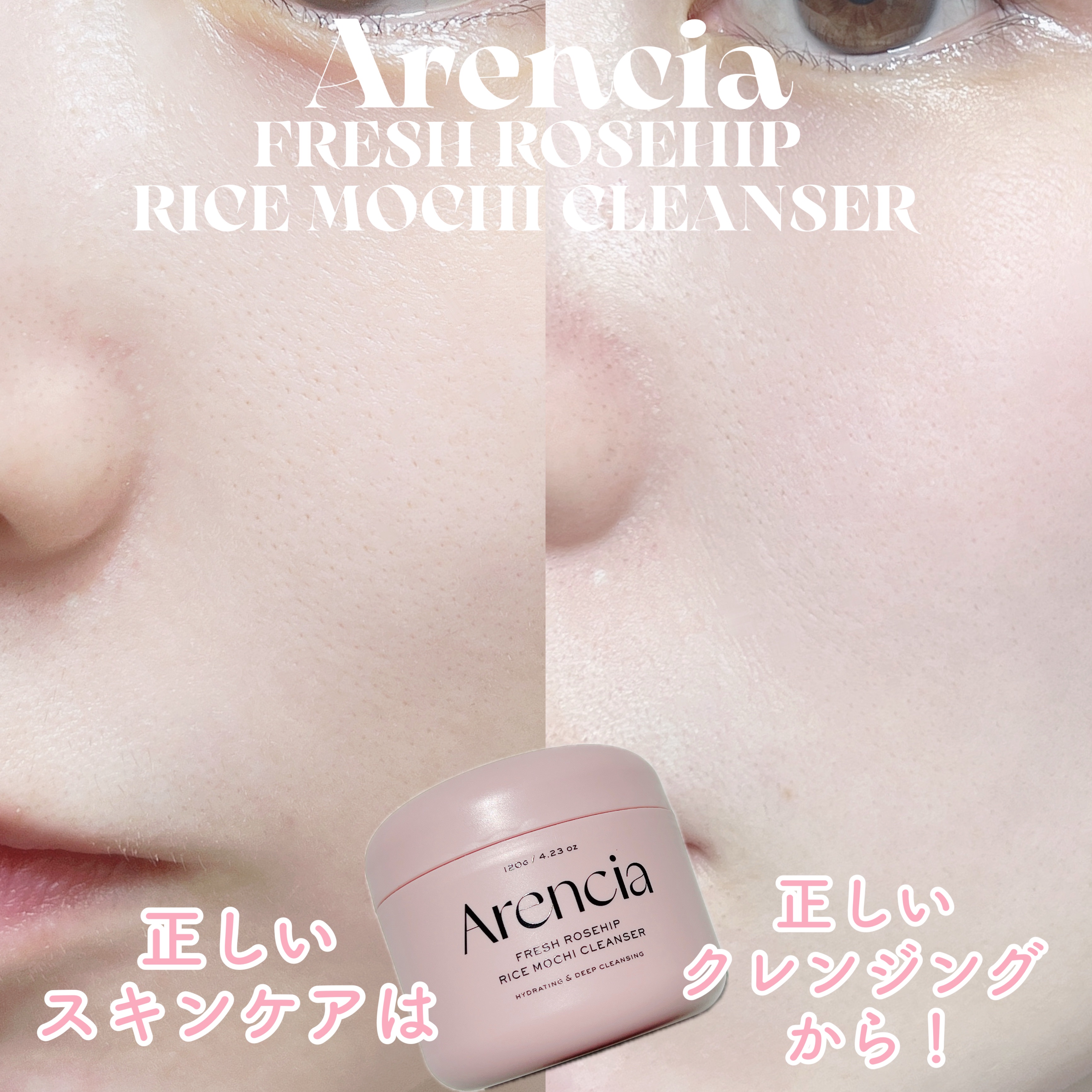 アレンシアフレッシュもちソープ「ロイヤルローズヒップ」/アレンシア/その他洗顔料を使ったクチコミ（1枚目）