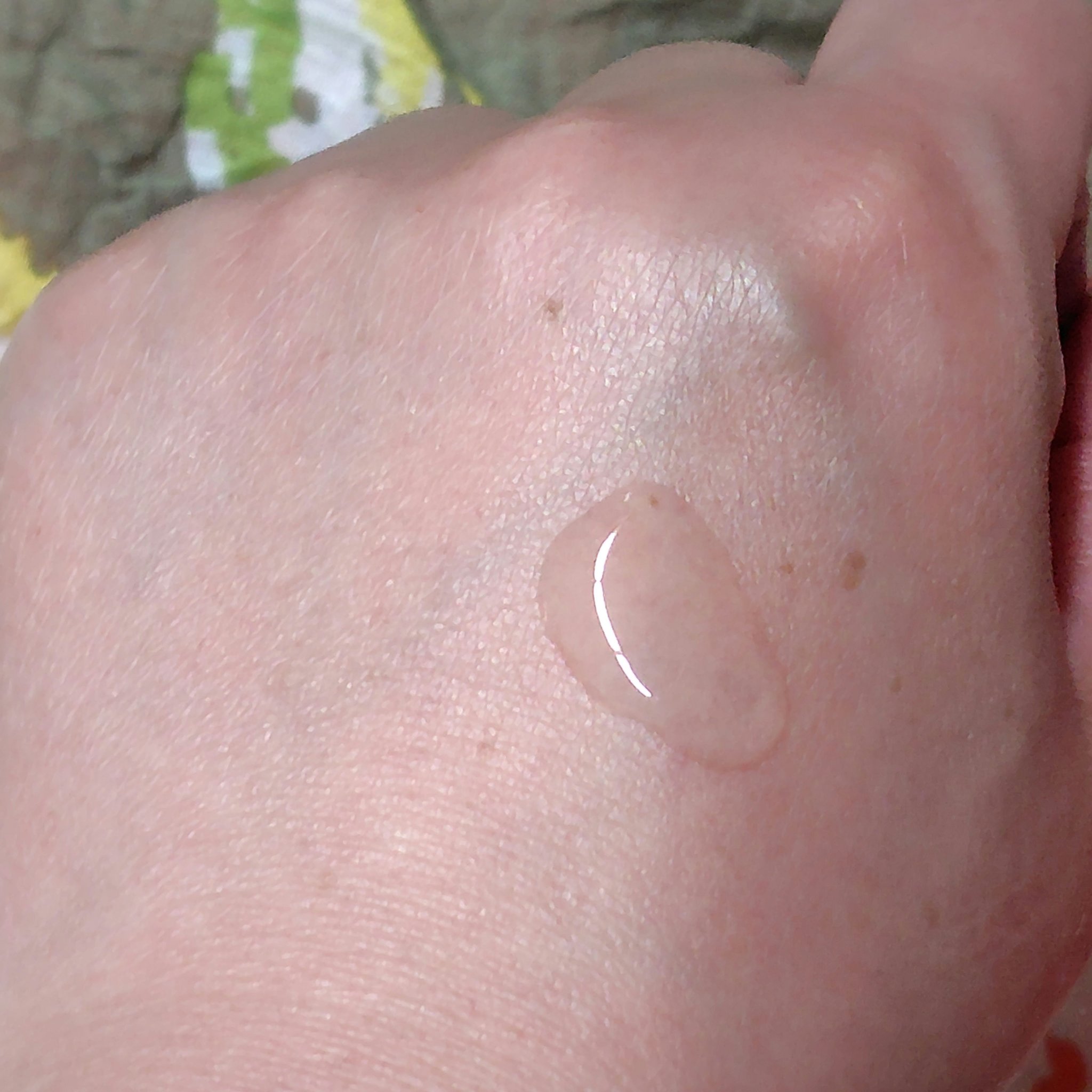 リンクルケアプラス化粧水/ケシミン/化粧水を使ったクチコミ（3枚目）