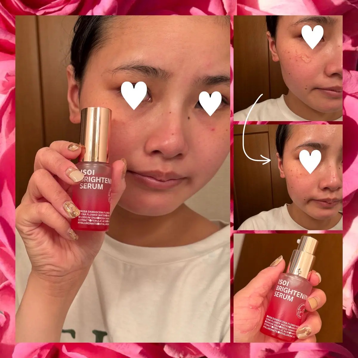 ブレミッシュケアアップ セラム/ISOI/美容液を使ったクチコミ（2枚目）