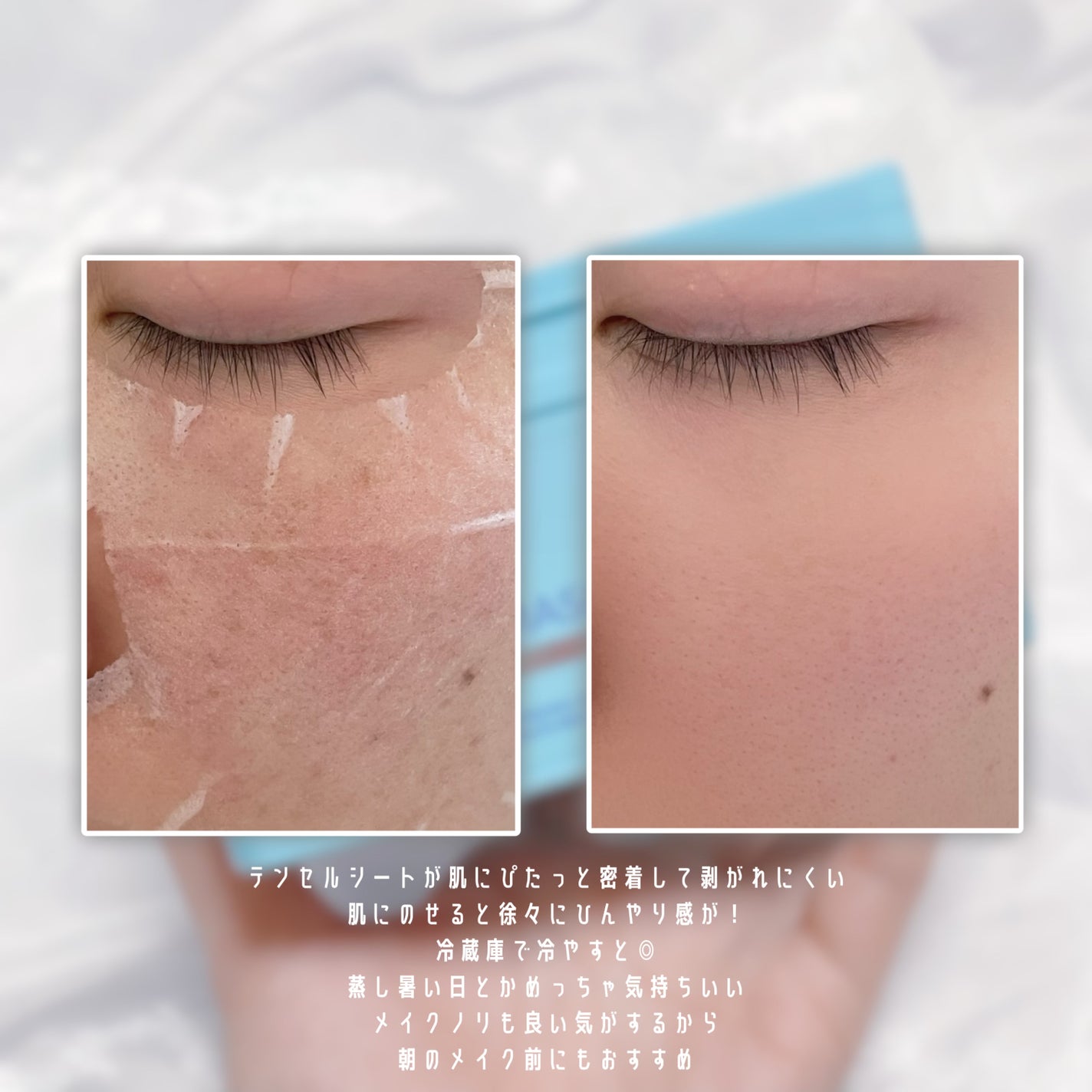 クライオアイス マスク/VT/シートマスク・パックを使ったクチコミ(3枚目)