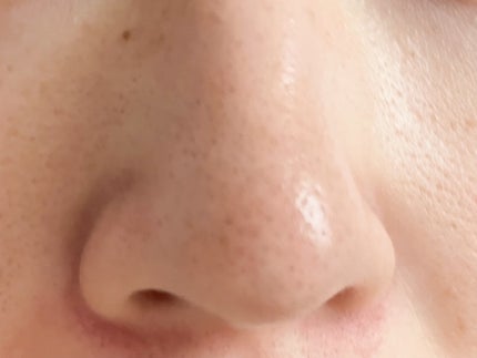 AZケア クレンジングオイル/VT/オイルクレンジングを使ったクチコミ(5枚目)