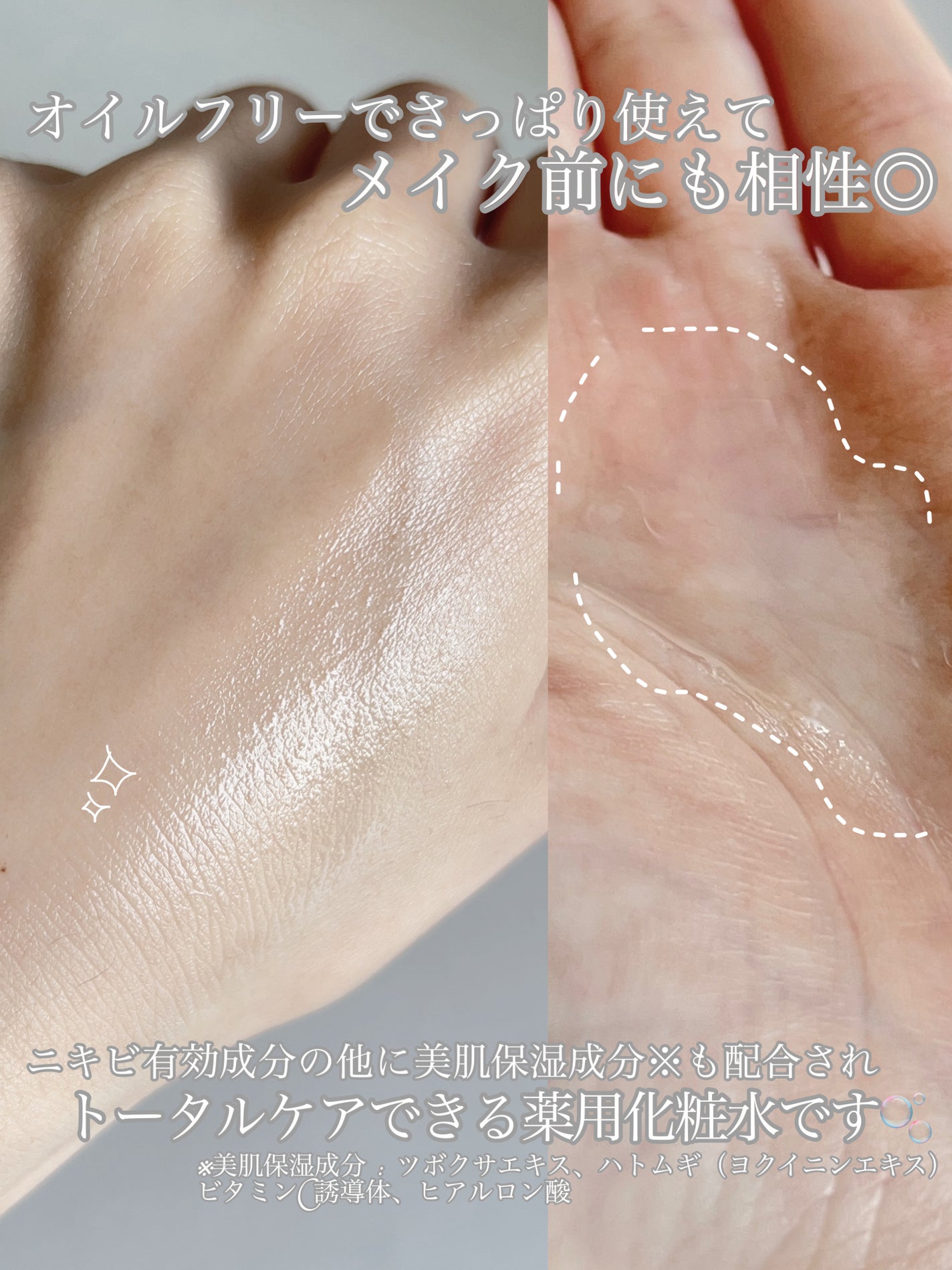 薬用化粧水/スキンライフ/化粧水を使ったクチコミ(4枚目)