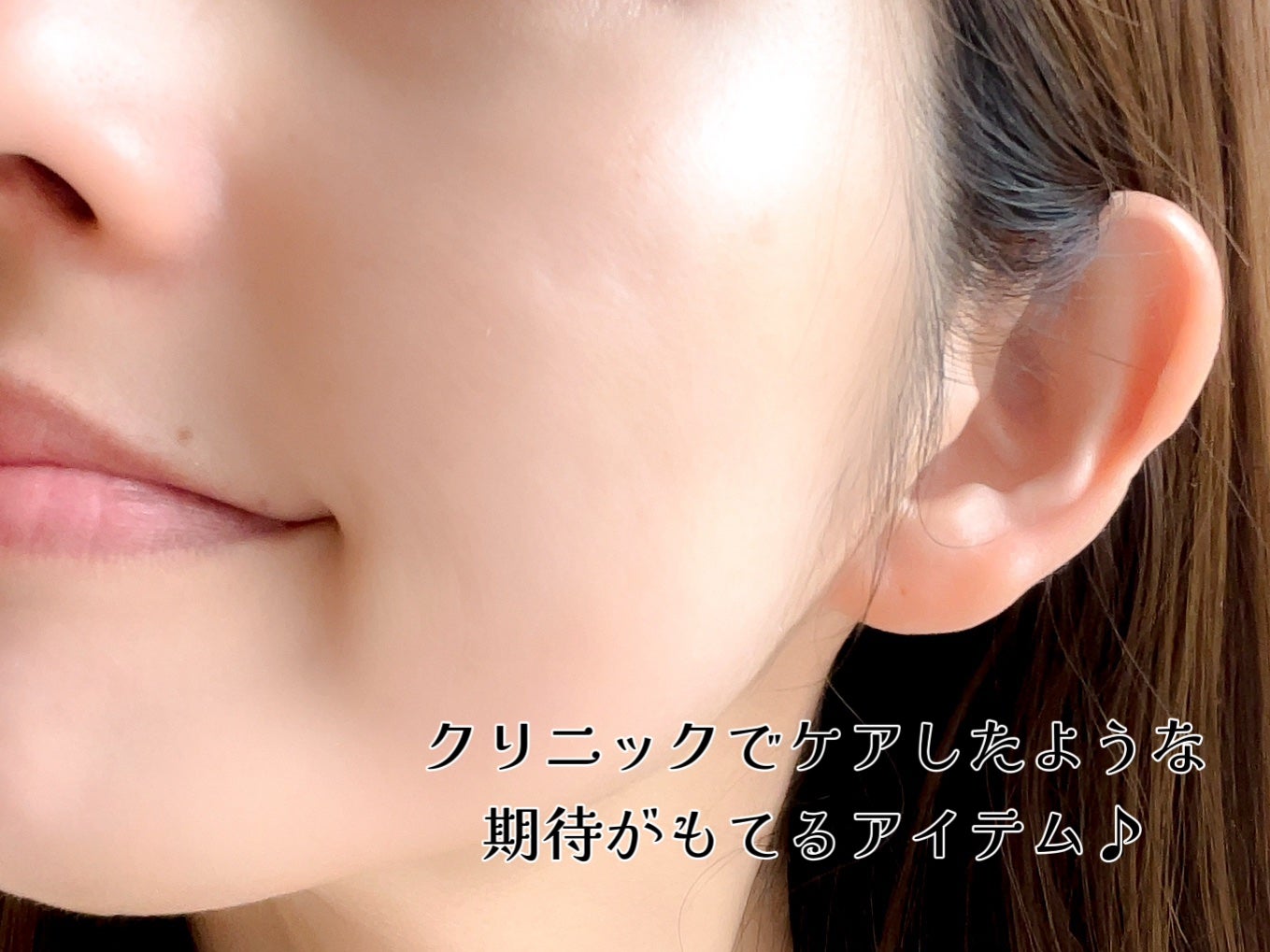 EXO−Vプロリフティング MTSアンプル/id PLACOSMETICS/美容液を使ったクチコミ(4枚目)