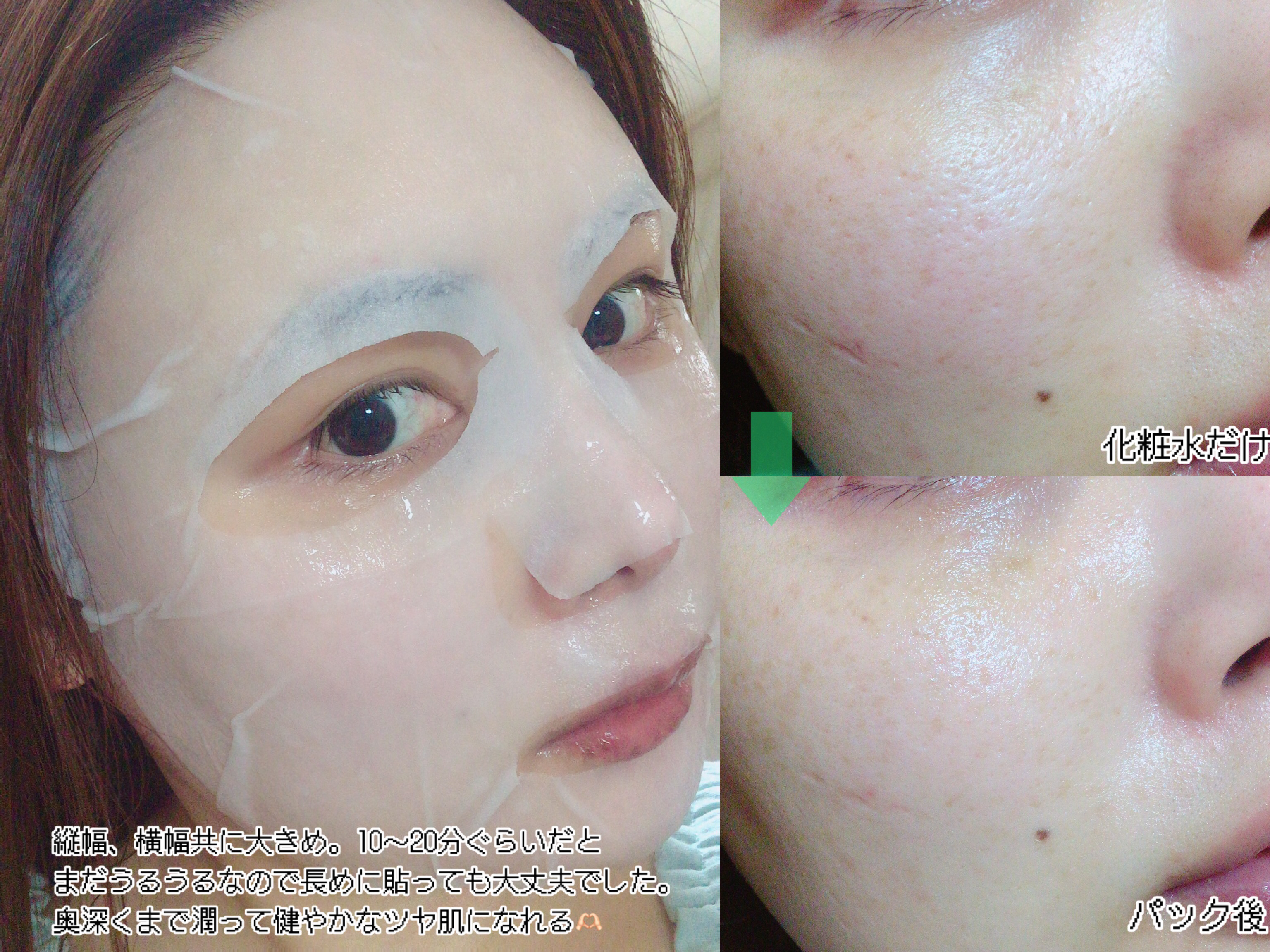 リードルS PDRN+ マスク/VT/シートマスク・パックを使ったクチコミ（3枚目）