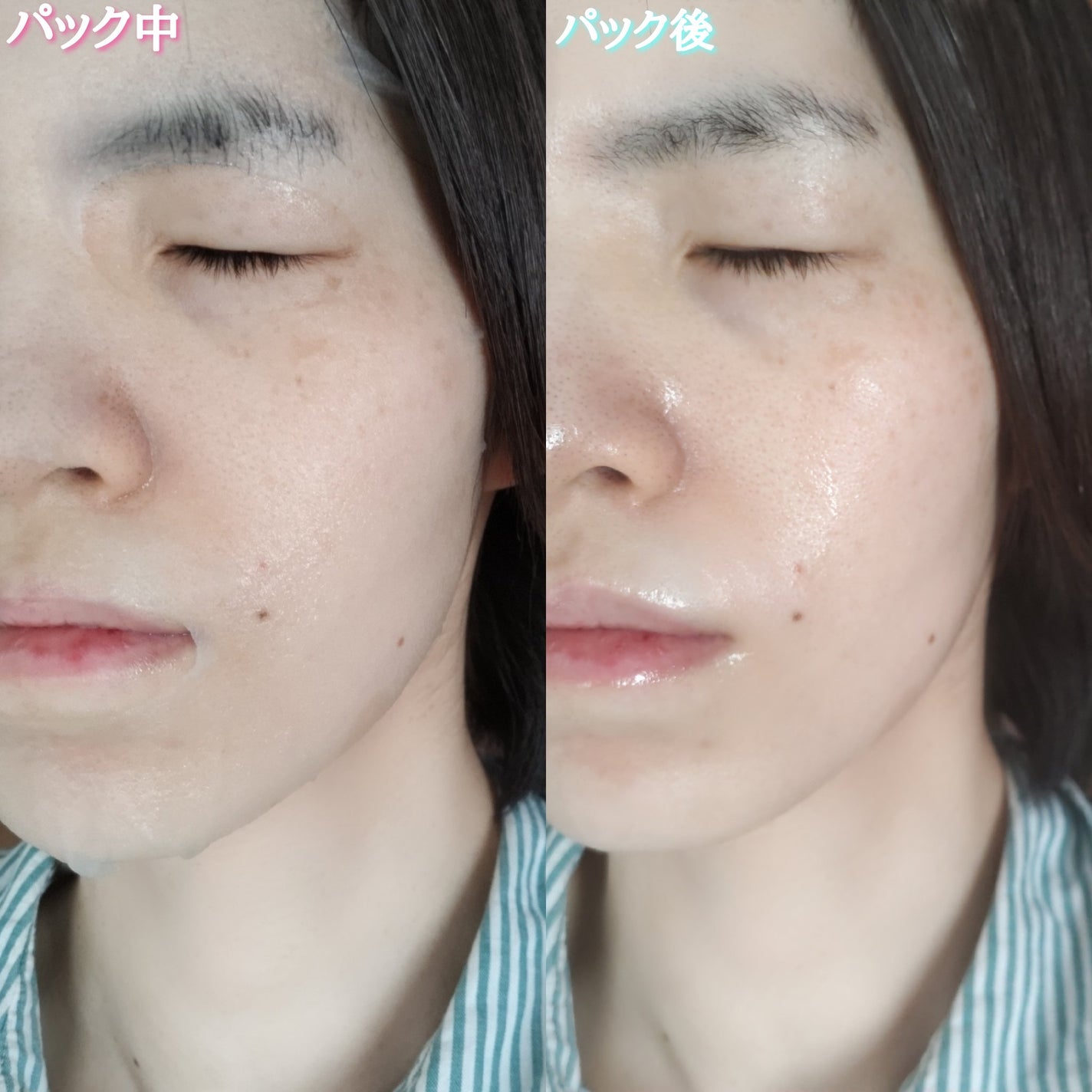 ナンバーズイン 1番 ヒアルロニックパントテン酸ガーゼマスク/numbuzin/シートマスク・パックを使ったクチコミ(6枚目)