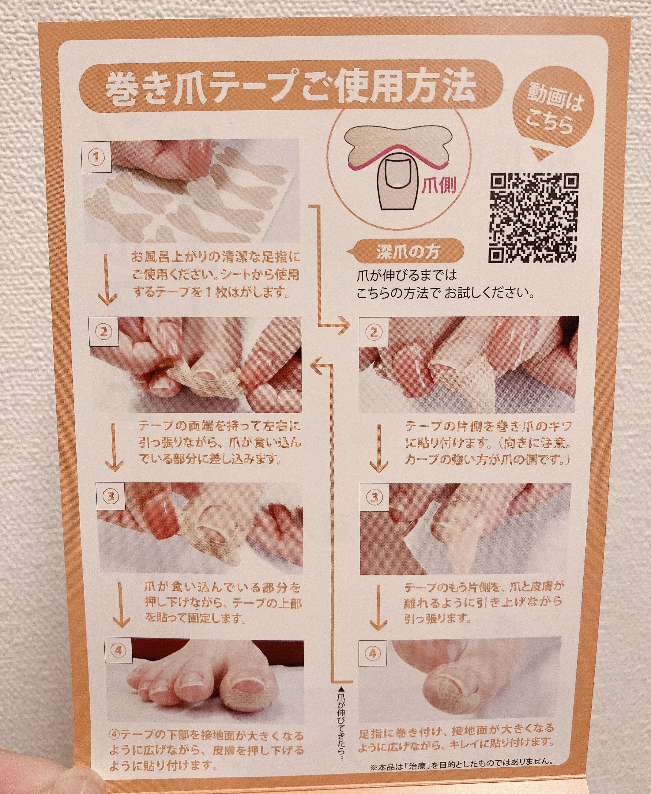 巻き爪テープ/足の快適工房/レッグ・フットケアを使ったクチコミ（3枚目）