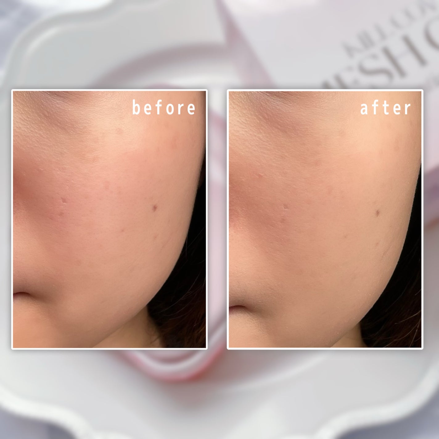 キルカバー メッシュ グロウ エッセンシャル クッション/CLIO/クッションファンデーションを使ったクチコミ(3枚目)