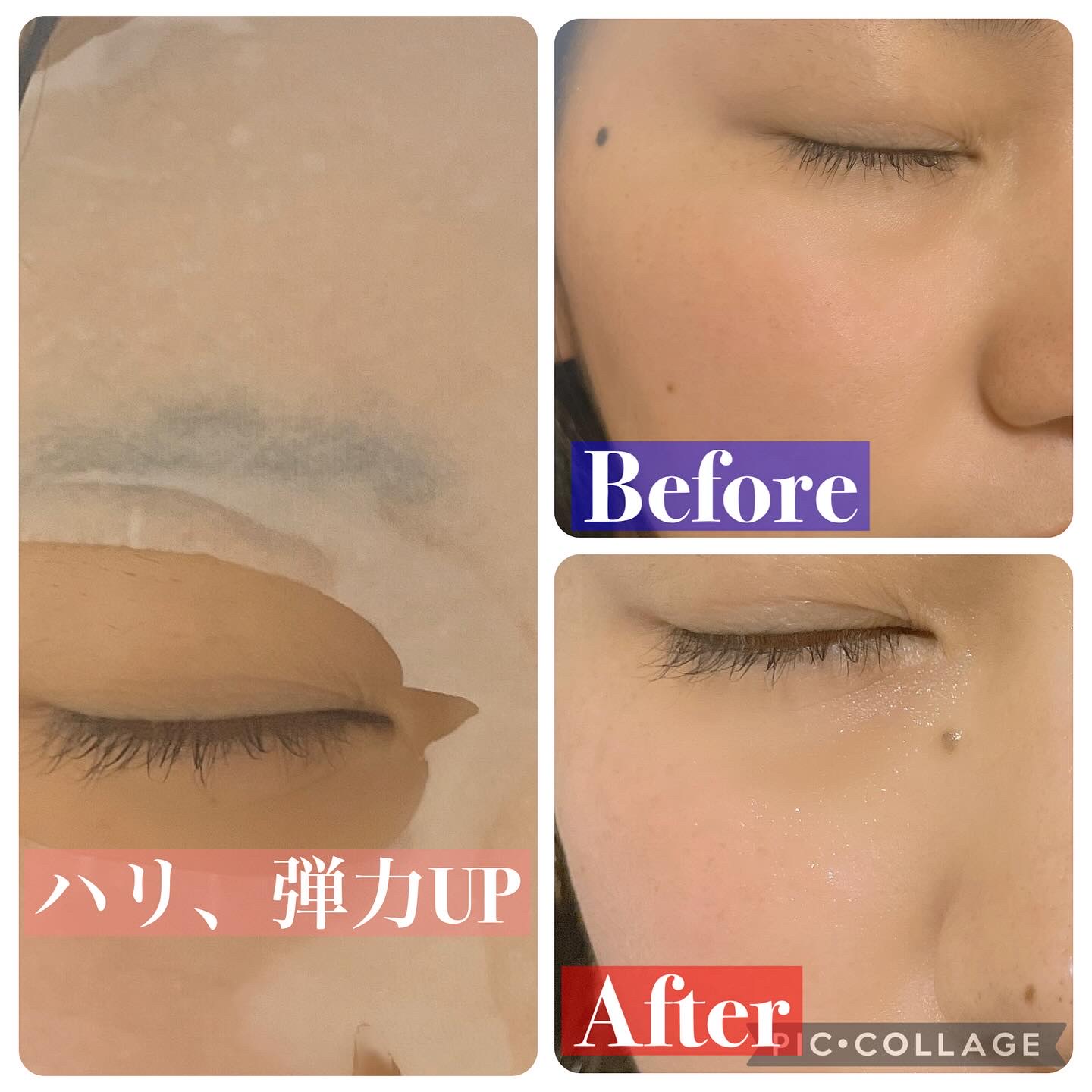 PHセンシティブマスク バイタルフィット/SAM'U/シートマスク・パックを使ったクチコミ（2枚目）