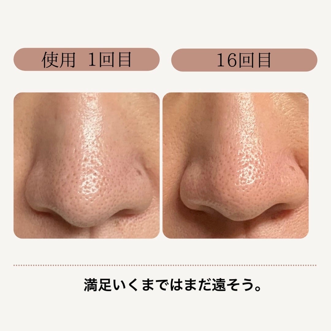 AQ 毛穴美容液オイル/DECORTÉ/フェイスオイルを使ったクチコミ(3枚目)