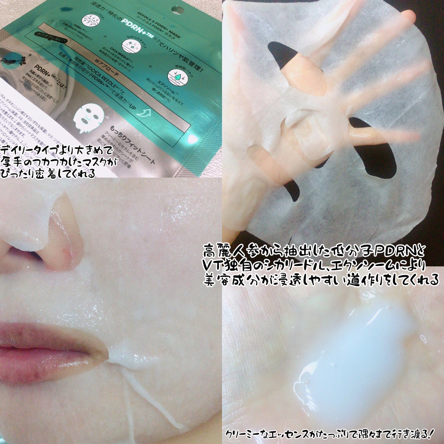 リードルS PDRN+ マスク/VT/シートマスク・パックを使ったクチコミ(2枚目)