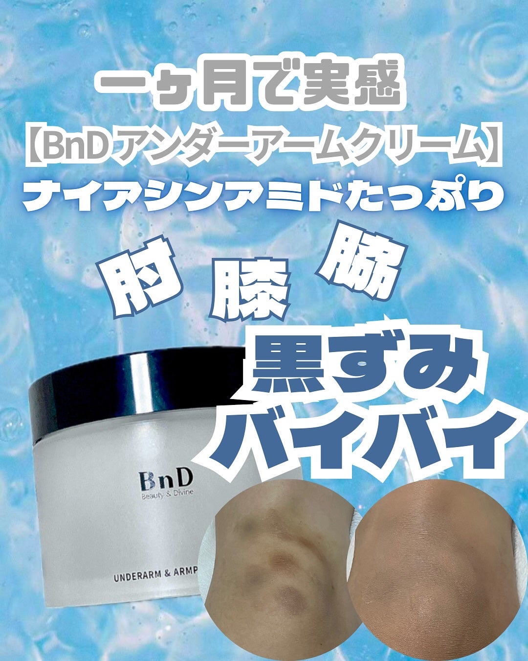 BnDアンダーアームクリーム(ボディクリーム)/BnD/デリケートゾーンケアを使ったクチコミ(1枚目)