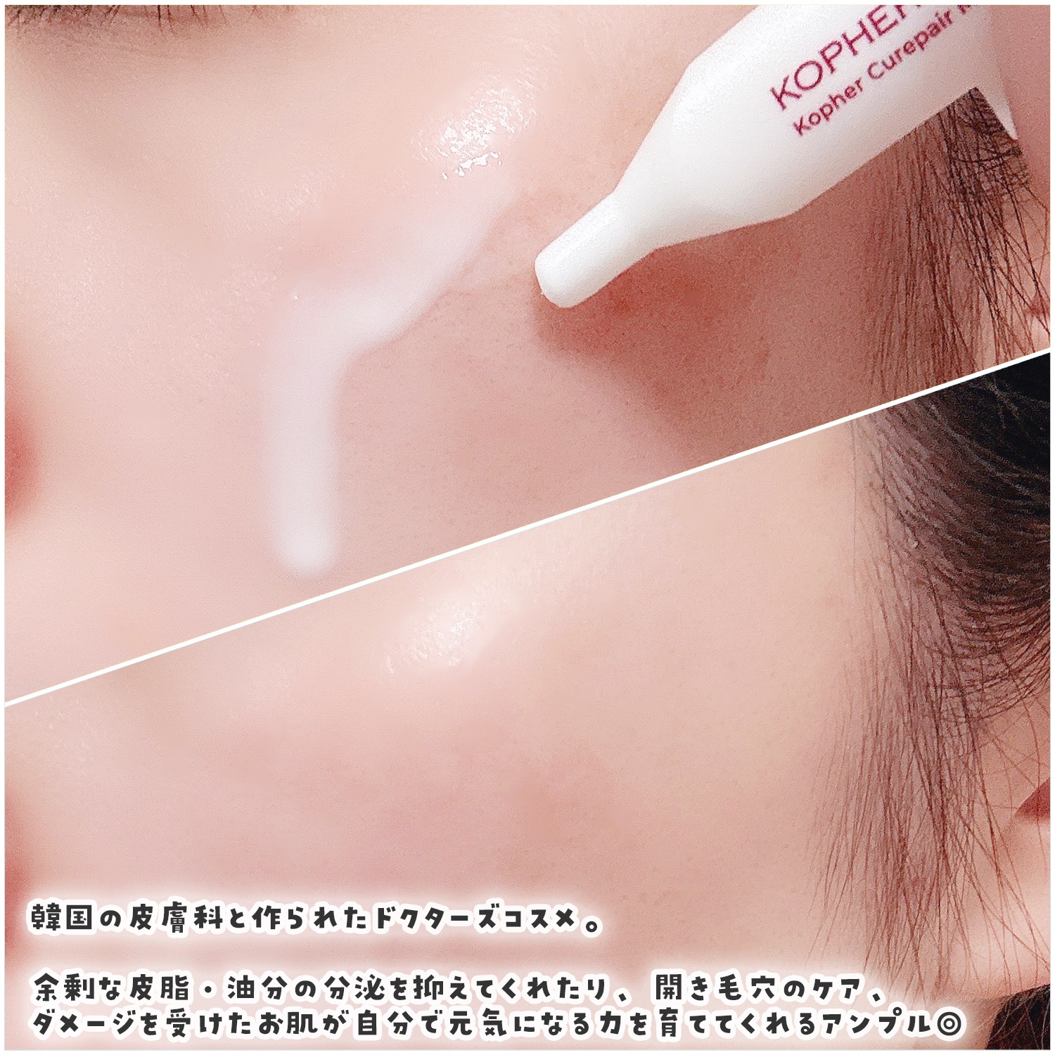 SOSメルダーシステム/KOPHER/フェイスクリームを使ったクチコミ（2枚目）