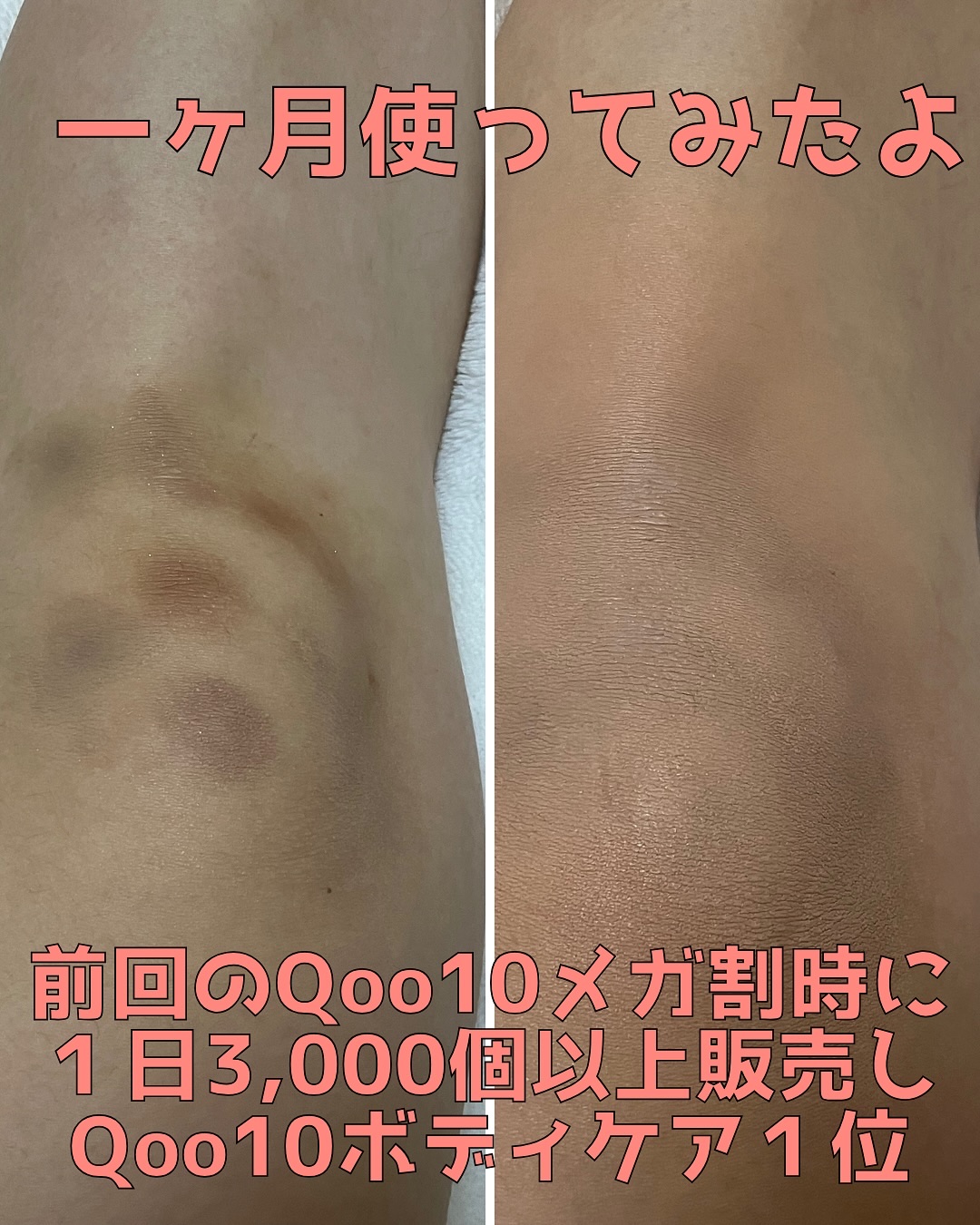 BnDアンダーアームクリーム(ボディクリーム)/BnD/デリケートゾーンケアを使ったクチコミ（3枚目）