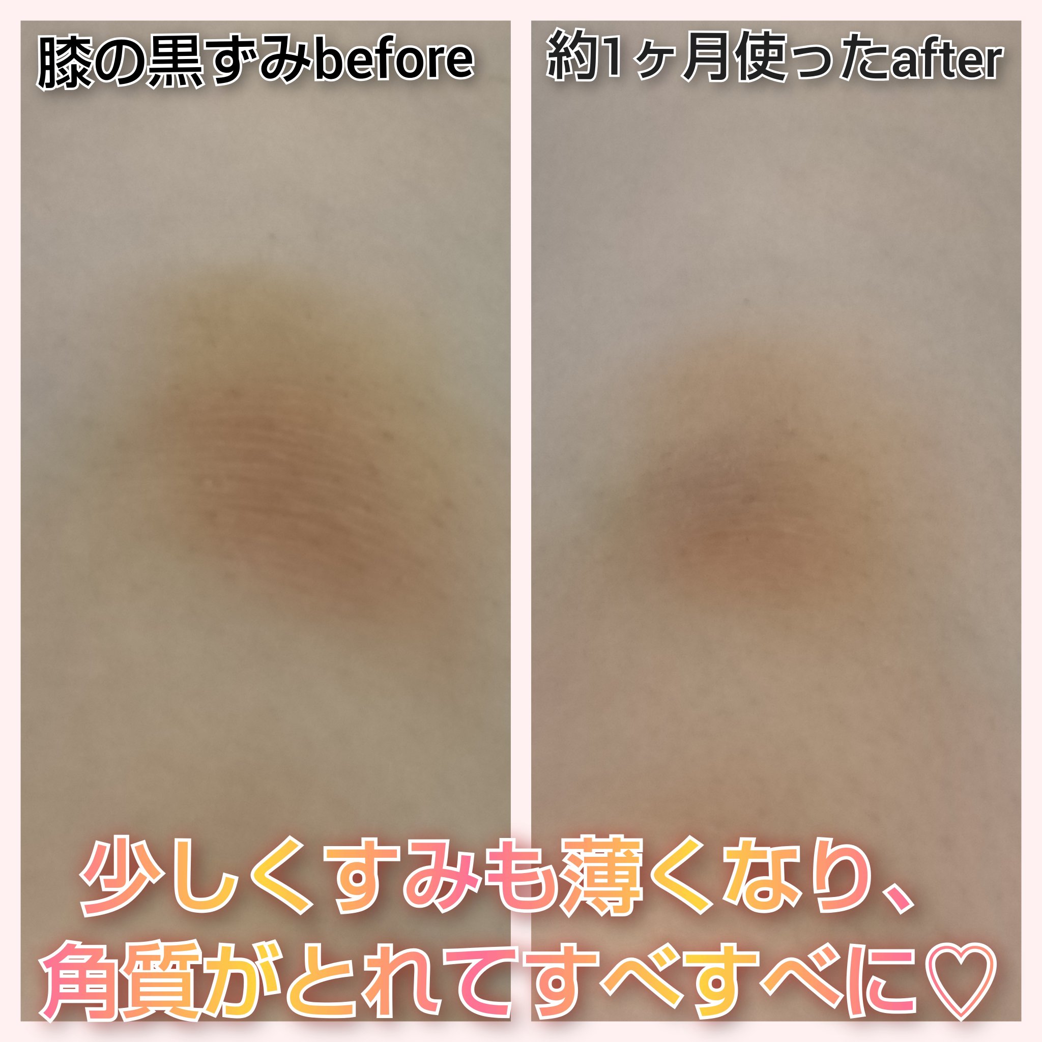 BnD マシュマロ コラーゲン AHA スクラブ /BnD/ボディスクラブを使ったクチコミ（3枚目）