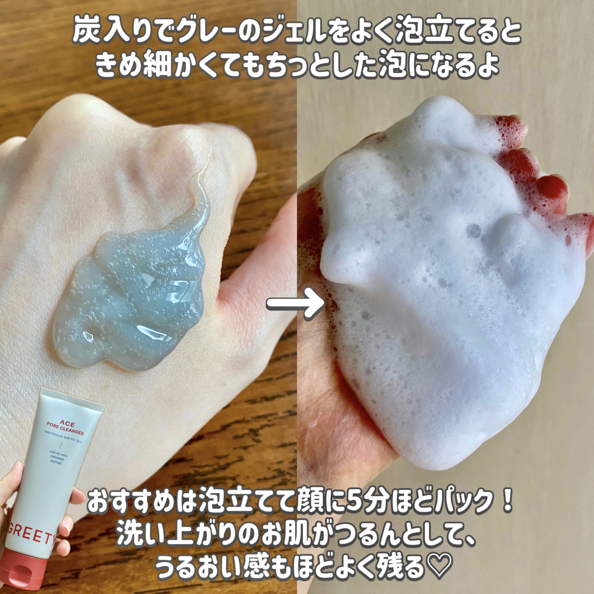 ACE pore cleanser /GREETY/洗顔フォームを使ったクチコミ（3枚目）
