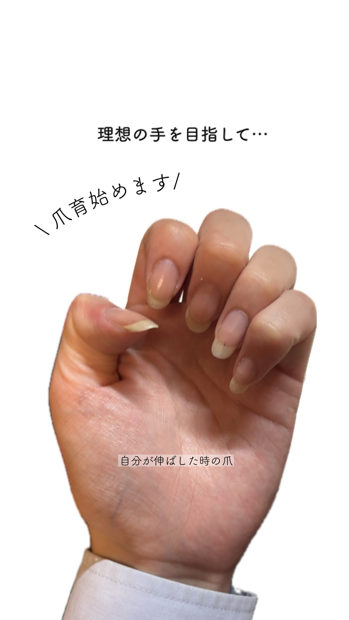 薬用ハンドクリーム しっとりタイプ/アトリックス/ハンドクリームを使ったクチコミ（1枚目）