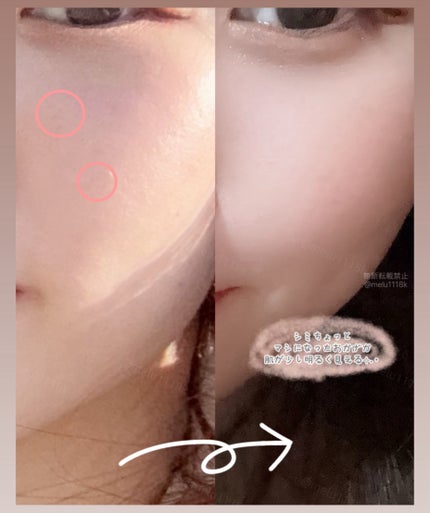 アルブチン スキンブースター セラム/MEDITHERAPY/美容液を使ったクチコミ(5枚目)