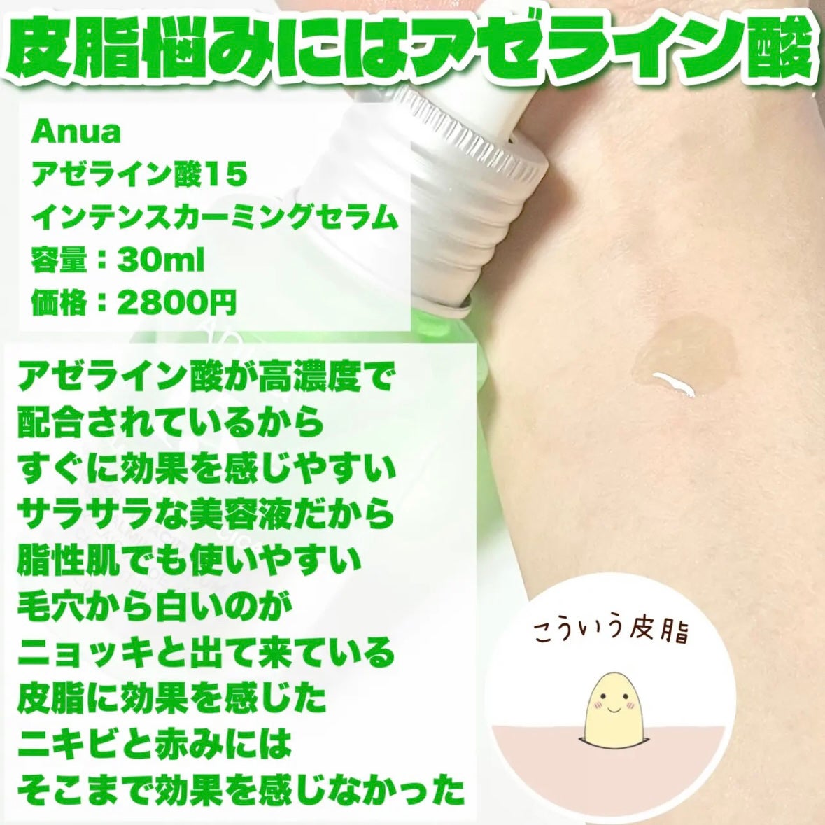 アゼライン酸15 インテンスカーミングセラム/Anua/美容液を使ったクチコミ(4枚目)