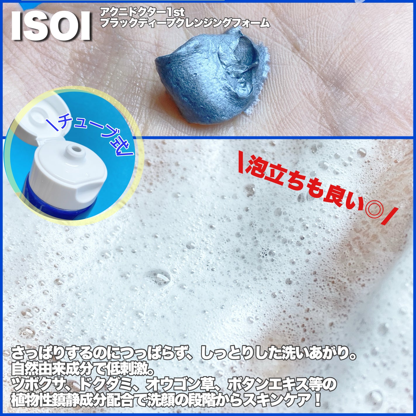 ACNI Dr. 1st Black Deep Clensing Foam/ISOI/洗顔フォームを使ったクチコミ(2枚目)