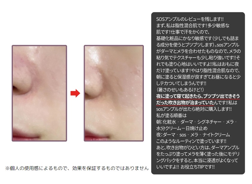 SOSメルダーシステム/KOPHER/フェイスクリームを使ったクチコミ（2枚目）