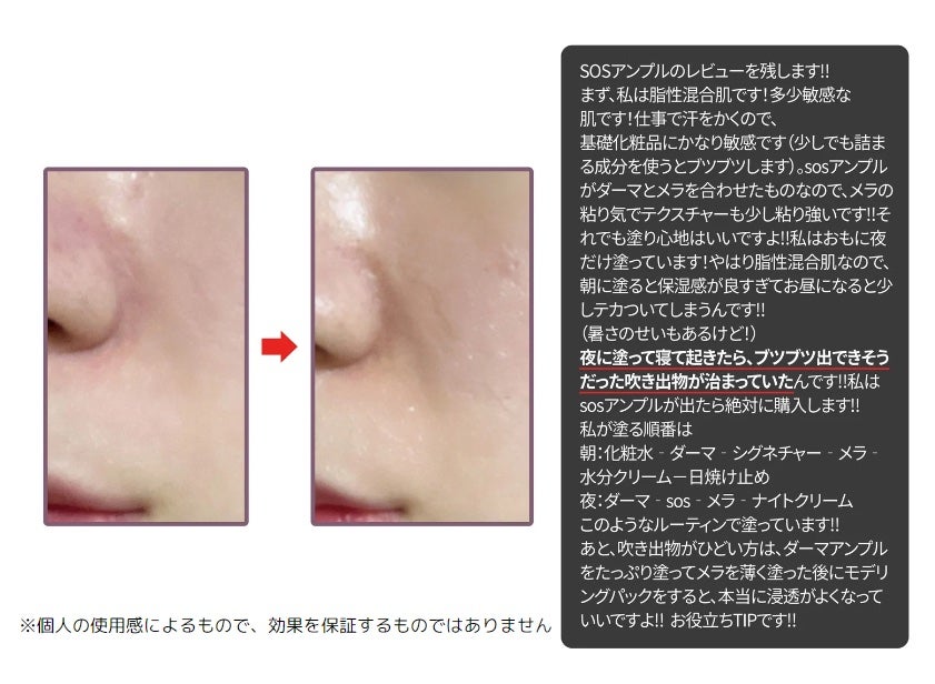 SOSメルダーシステム/KOPHER/フェイスクリームを使ったクチコミ(2枚目)