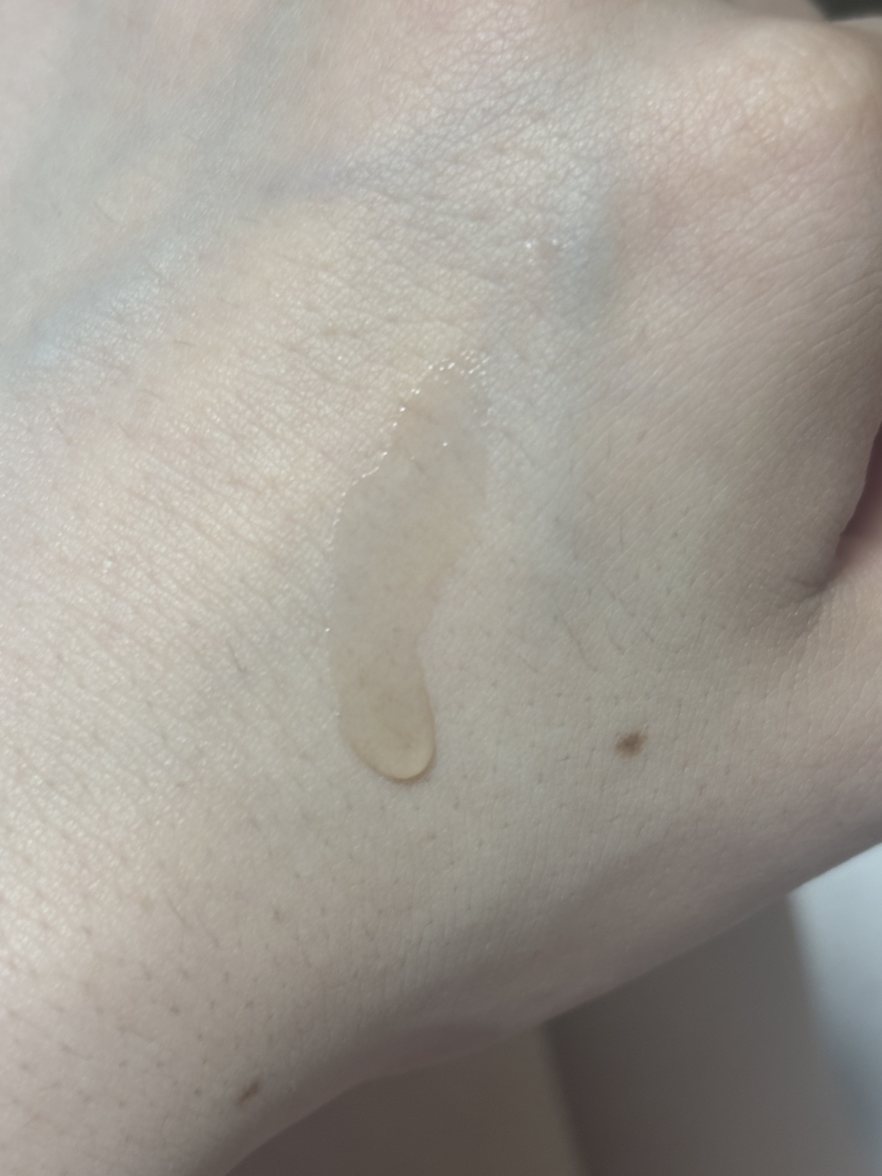 RXザ・アルファアルブチン2 ニキビ跡ケアセラム/COSRX/美容液を使ったクチコミ（2枚目）