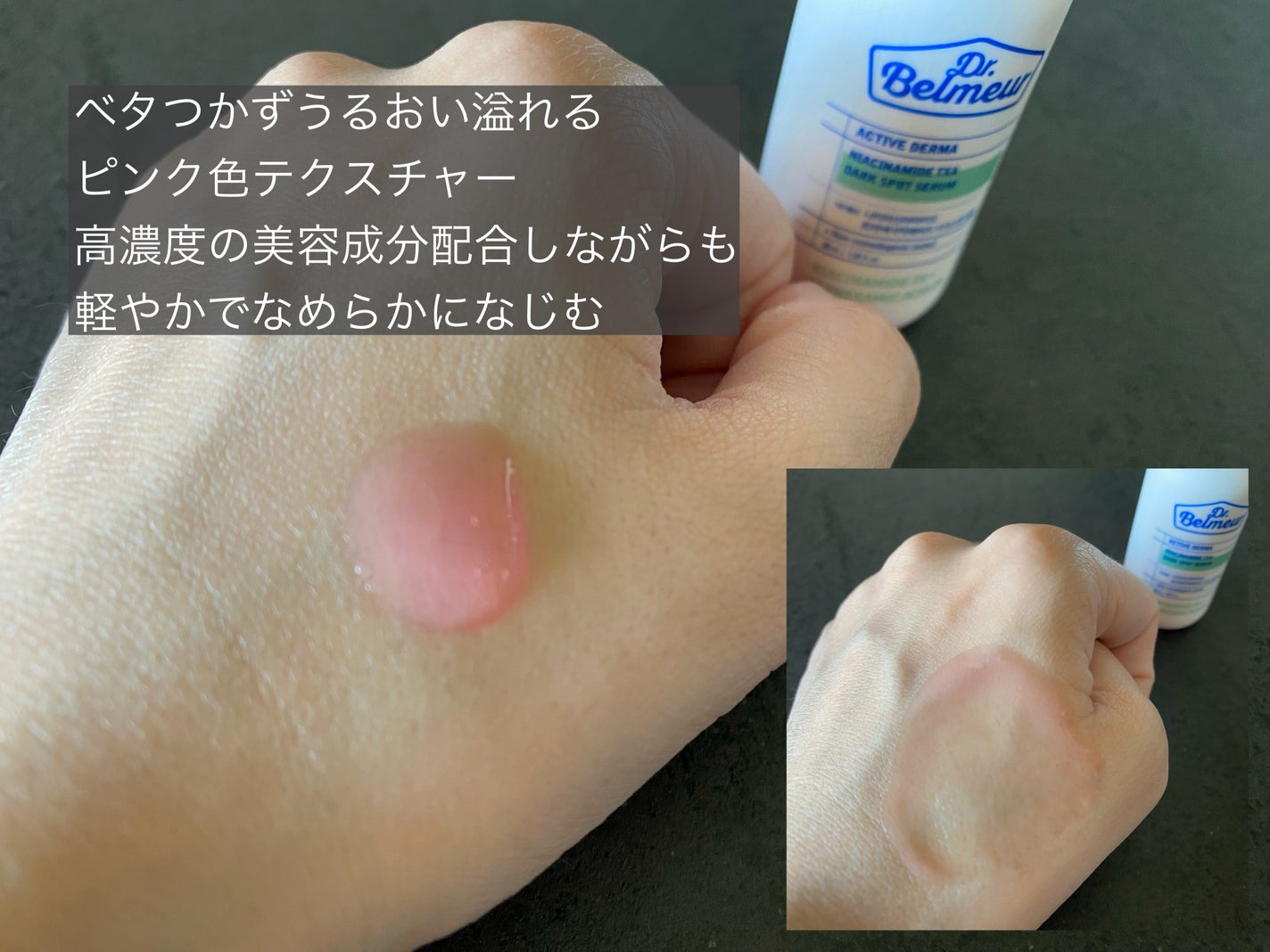 ナイアシンアミドTXA ダークスポットコレクティングセラム/Dr.Belmeur/美容液を使ったクチコミ(3枚目)