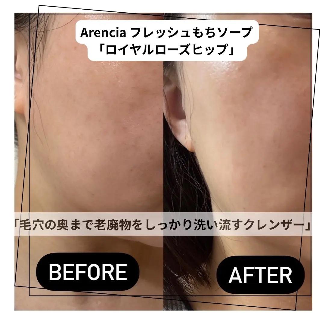 アレンシアフレッシュもちソープ「ロイヤルローズヒップ」/アレンシア/その他洗顔料を使ったクチコミ（2枚目）