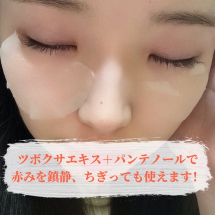 センテラ クイックカーミングパッド/SKIN1004/トナーパッドを使ったクチコミ(5枚目)