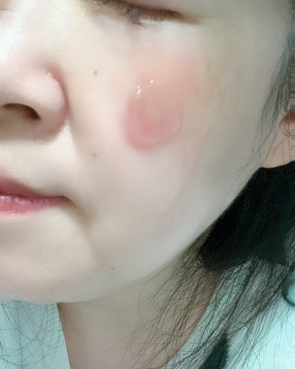 レッドモチセラム8/アレンシア/美容液を使ったクチコミ(5枚目)