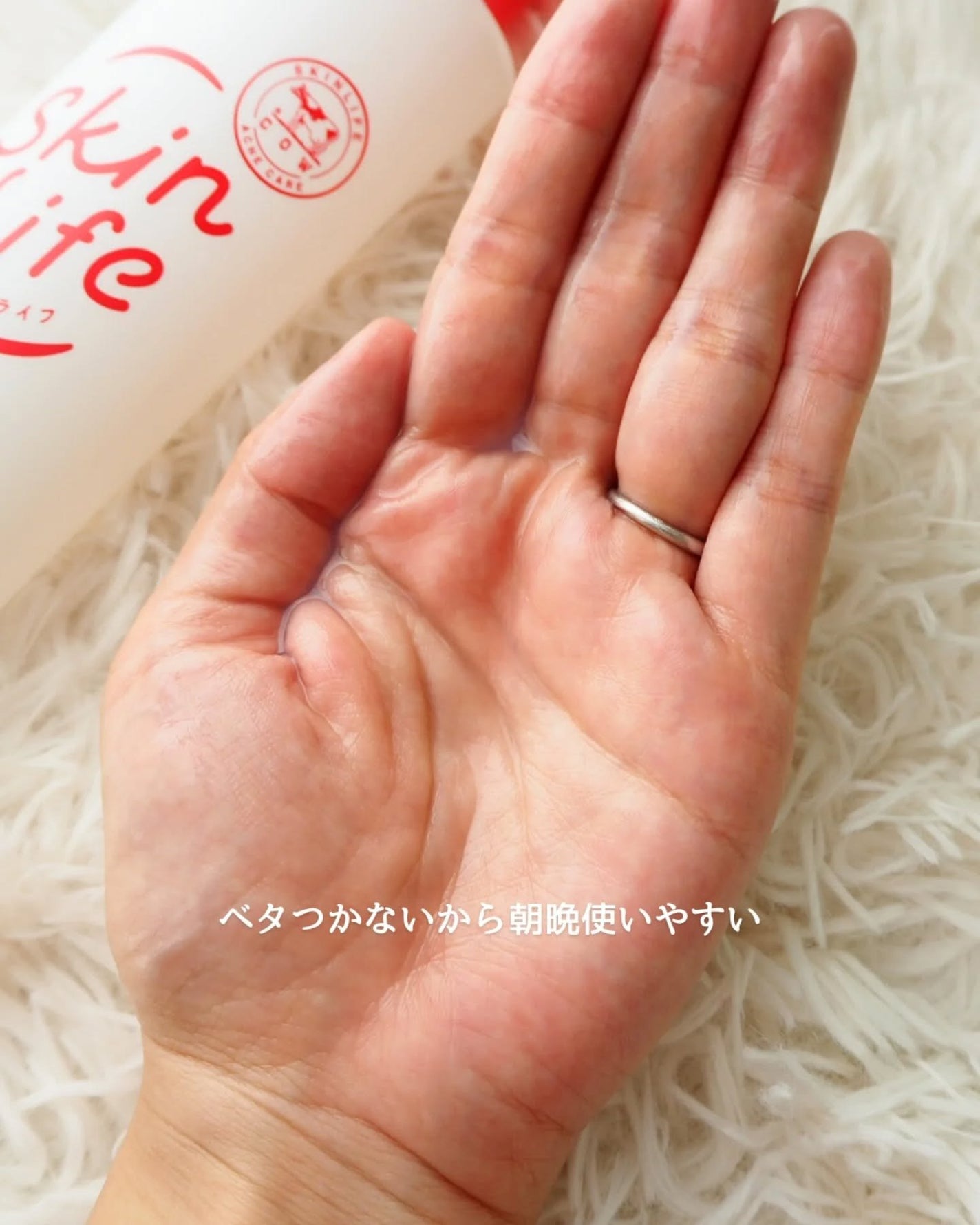 薬用化粧水/スキンライフ/化粧水を使ったクチコミ(4枚目)