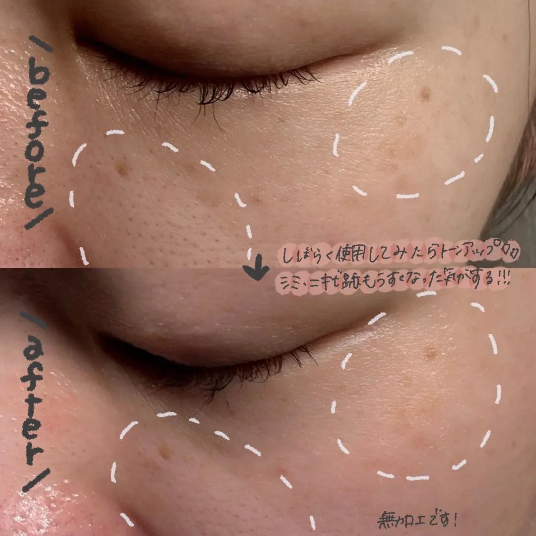 トラネキサム酸スキンブースタークリーム/MEDITHERAPY/フェイスクリームを使ったクチコミ（3枚目）