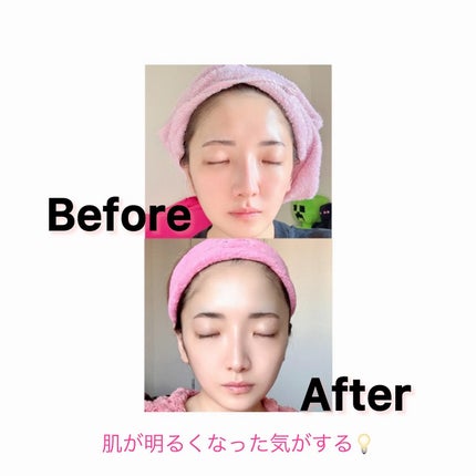 アルブチン スキンブースター セラム/MEDITHERAPY/美容液を使ったクチコミ(6枚目)