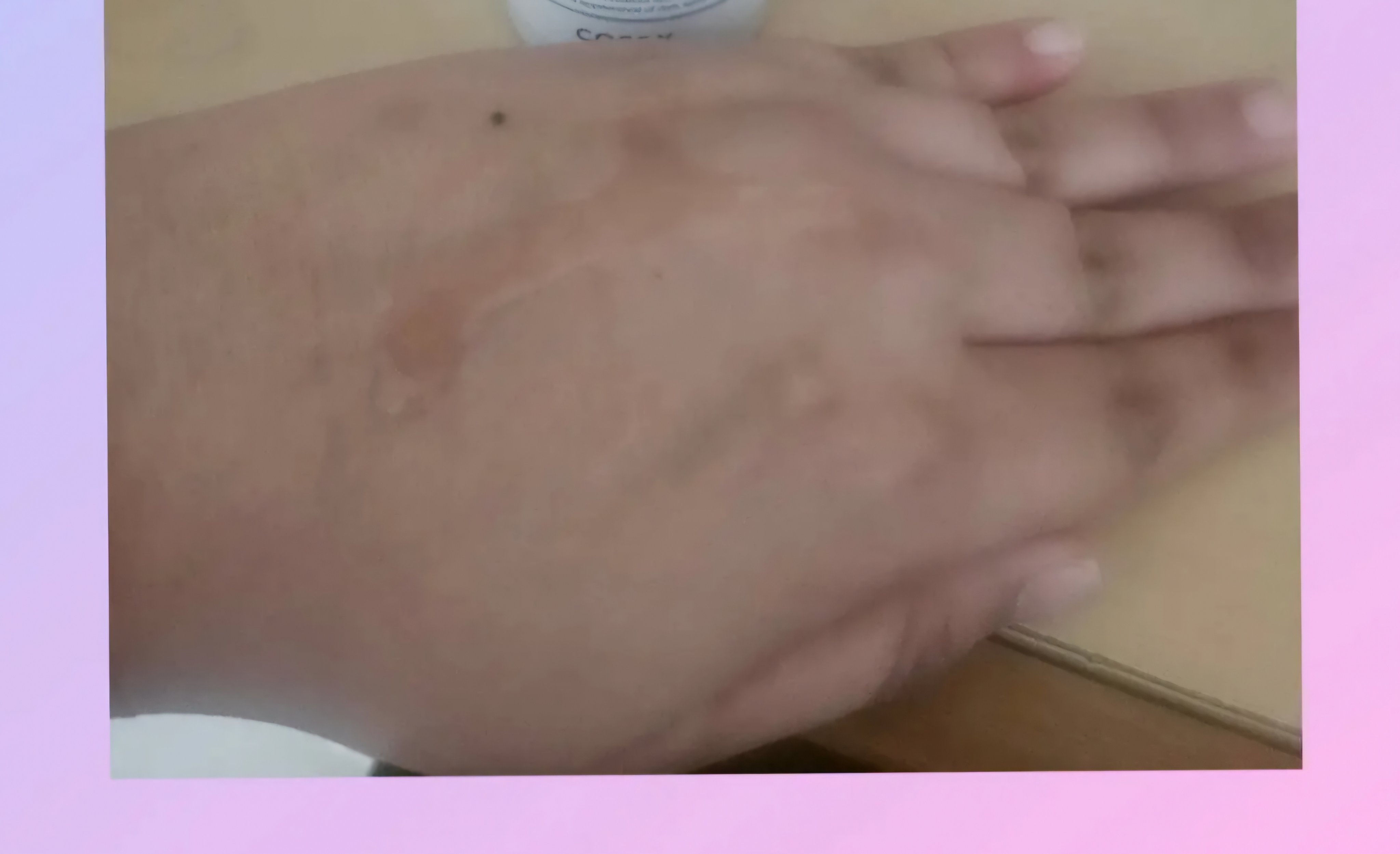 RXザ・アルファアルブチン2 ニキビ跡ケアセラム/COSRX/美容液を使ったクチコミ（2枚目）