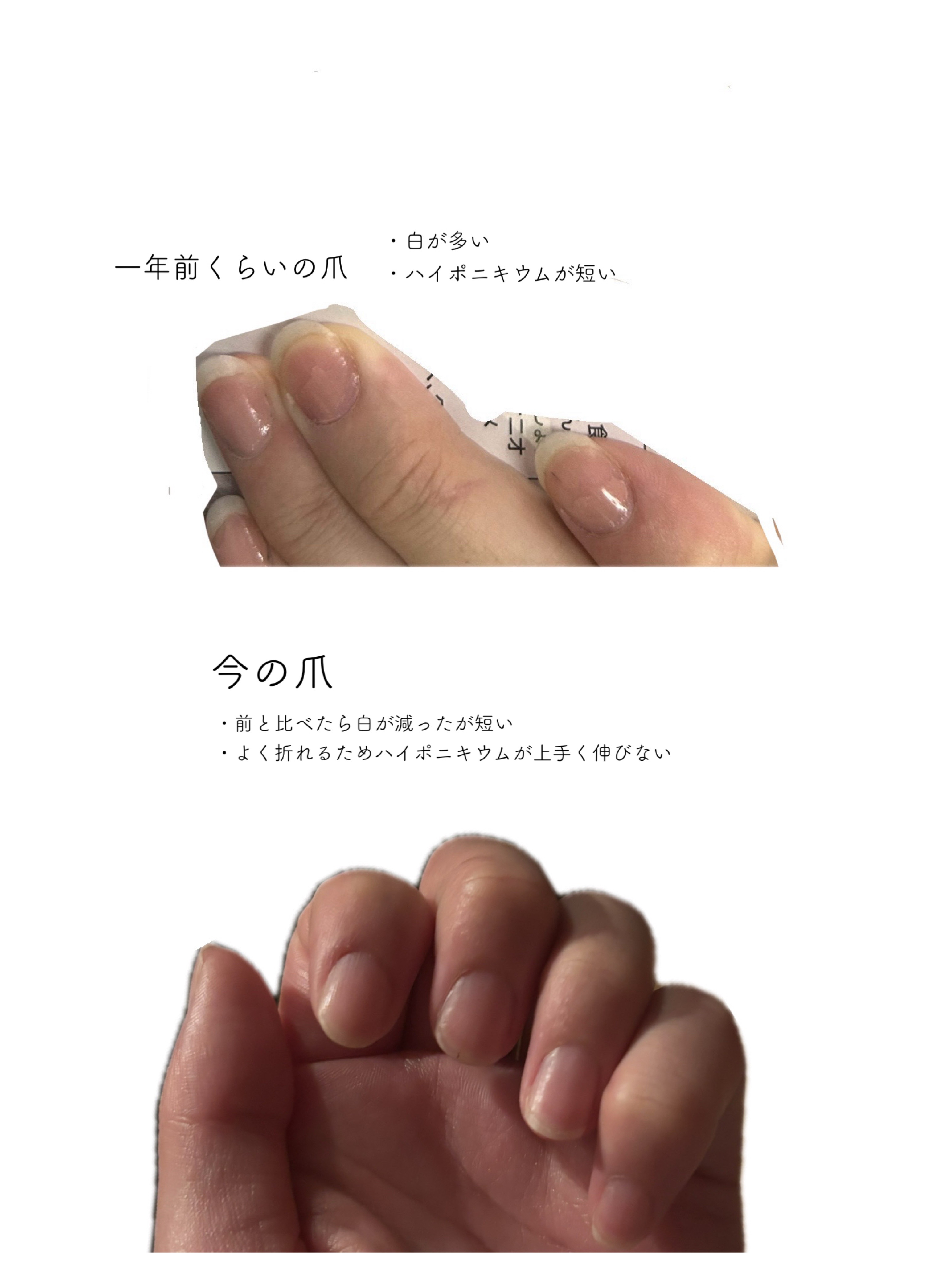 薬用ハンドクリーム しっとりタイプ/アトリックス/ハンドクリームを使ったクチコミ（2枚目）