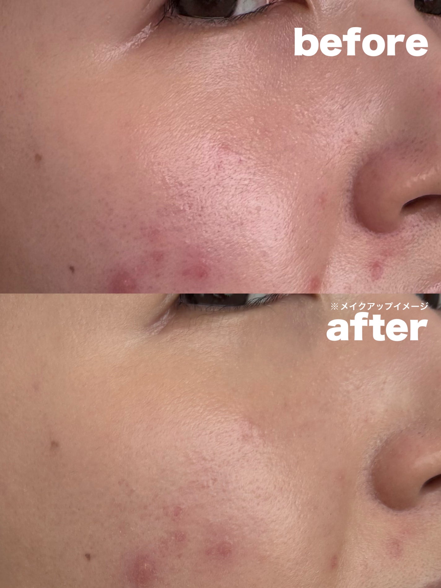 ã¢ã³ãªãããã ã±ã¢ ã〠ã»ã©ã ãã¡ã³ããŒã·ã§ã³/shu uemura/ãªããããã¡ã³ããŒã·ã§ã³ã䜿ã£ãã¯ãã³ãïŒ4æç®ïŒ