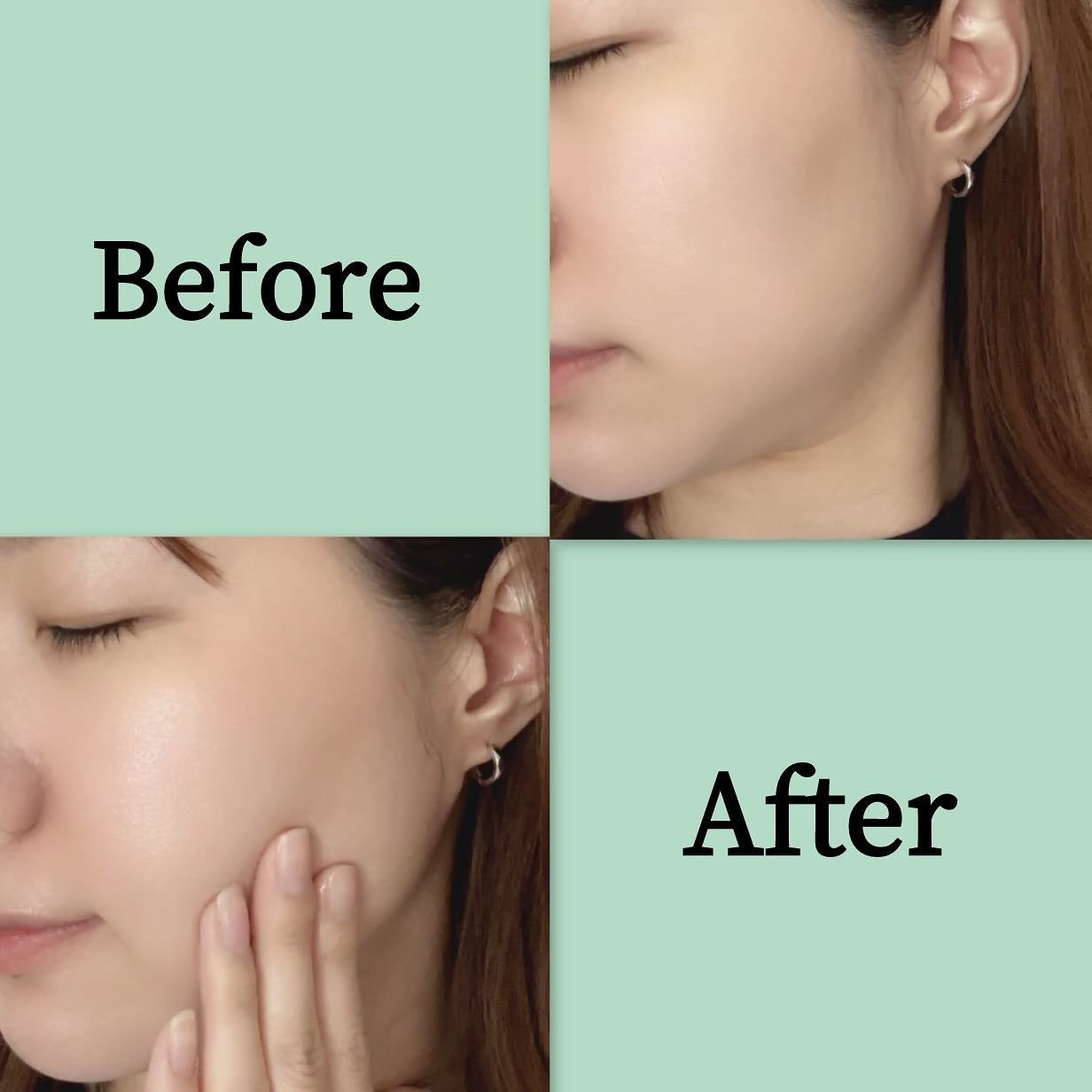 リードルS PDRN+ セラム/VT/美容液を使ったクチコミ(8枚目)