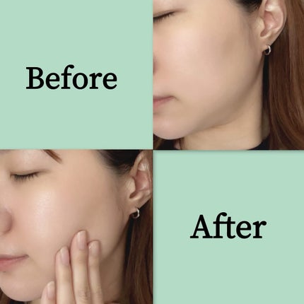 リードルS PDRN+ セラム/VT/美容液を使ったクチコミ(8枚目)