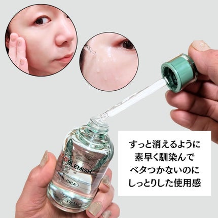 レッドブレミッシュ クリアスージングクリーム/Dr.G/フェイスクリームを使ったクチコミ(3枚目)