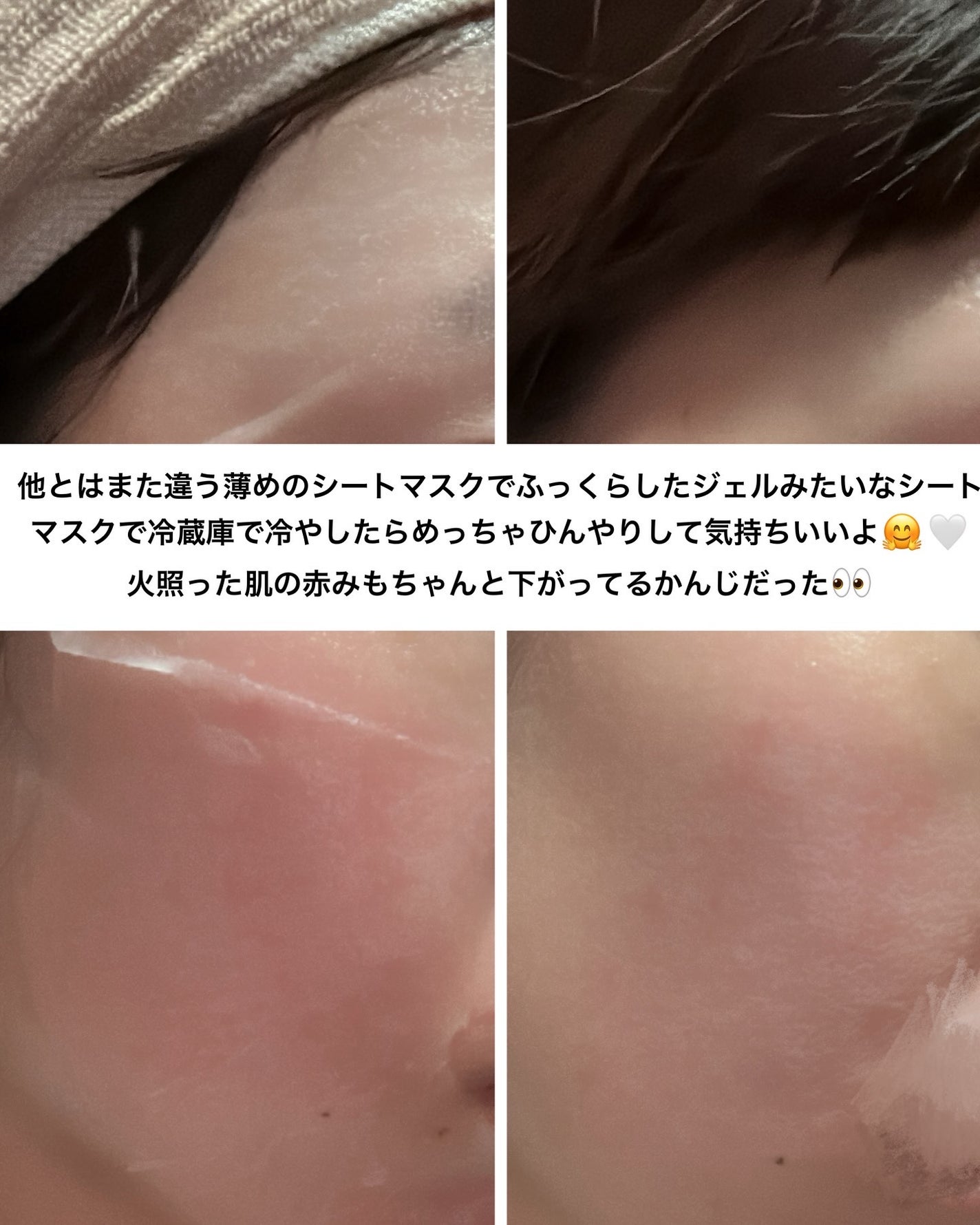 PHセンシティブマスクスージング&モイスト/SAM'U/シートマスク・パックを使ったクチコミ(5枚目)