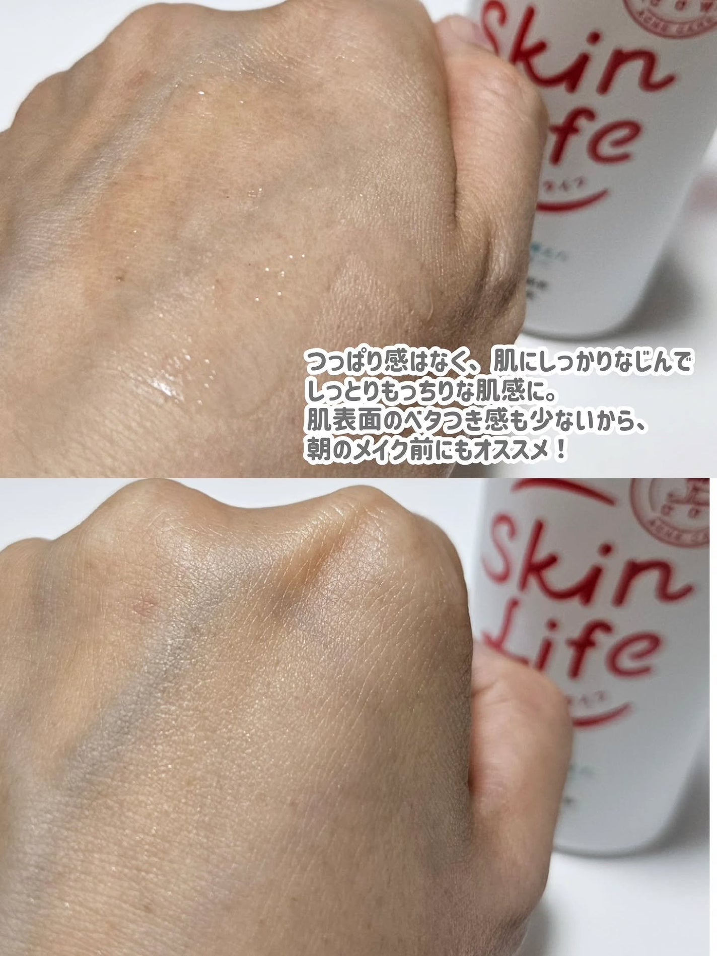 薬用化粧水/スキンライフ/化粧水を使ったクチコミ(3枚目)