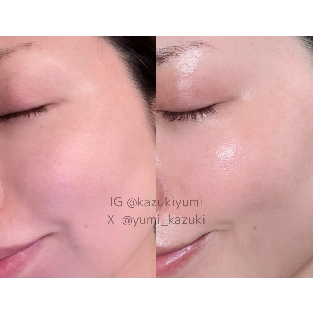 SOSメルダーシステム/KOPHER/フェイスクリームを使ったクチコミ（3枚目）