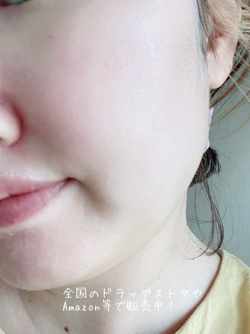 薬用化粧水/スキンライフ/化粧水を使ったクチコミ（3枚目）