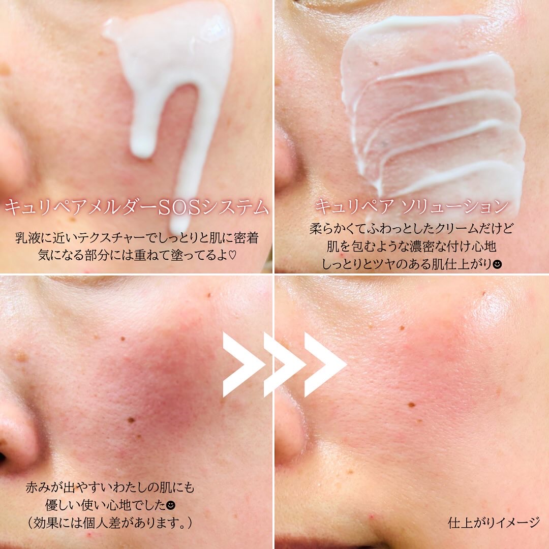 SOSメルダーシステム/KOPHER/フェイスクリームを使ったクチコミ（2枚目）