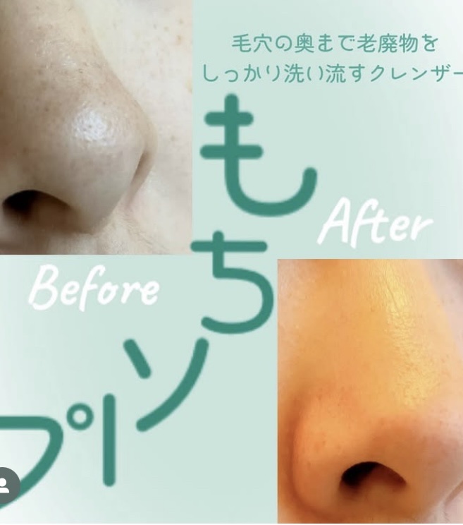 プレミアムもちソープ「グリーンアルティザン」/アレンシア/その他洗顔料を使ったクチコミ（1枚目）