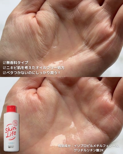 薬用化粧水/スキンライフ/化粧水を使ったクチコミ(3枚目)